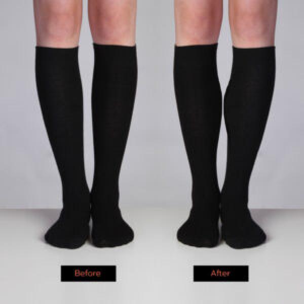 before & after shapely sock